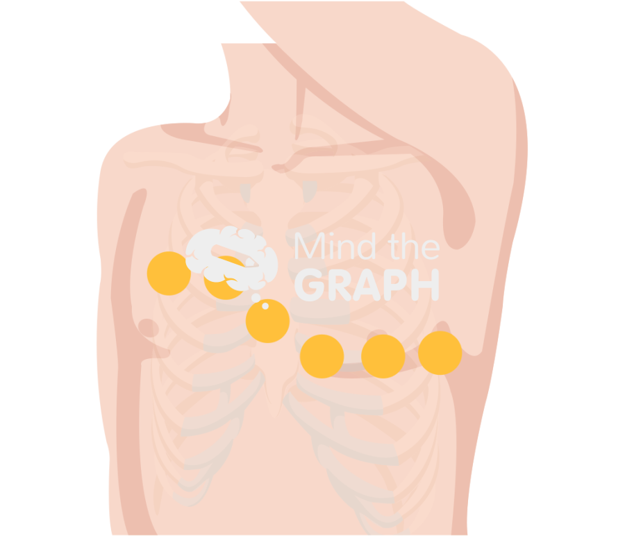 Chest thorax leads ecg lateral Icons, Symbols, Pictures, and Images