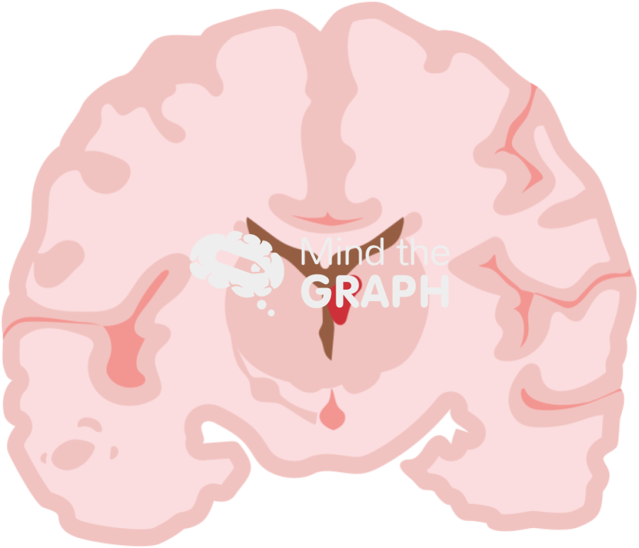 Childish brain hemorragia 1 front cut Icons, Symbols, Pictures, and Images