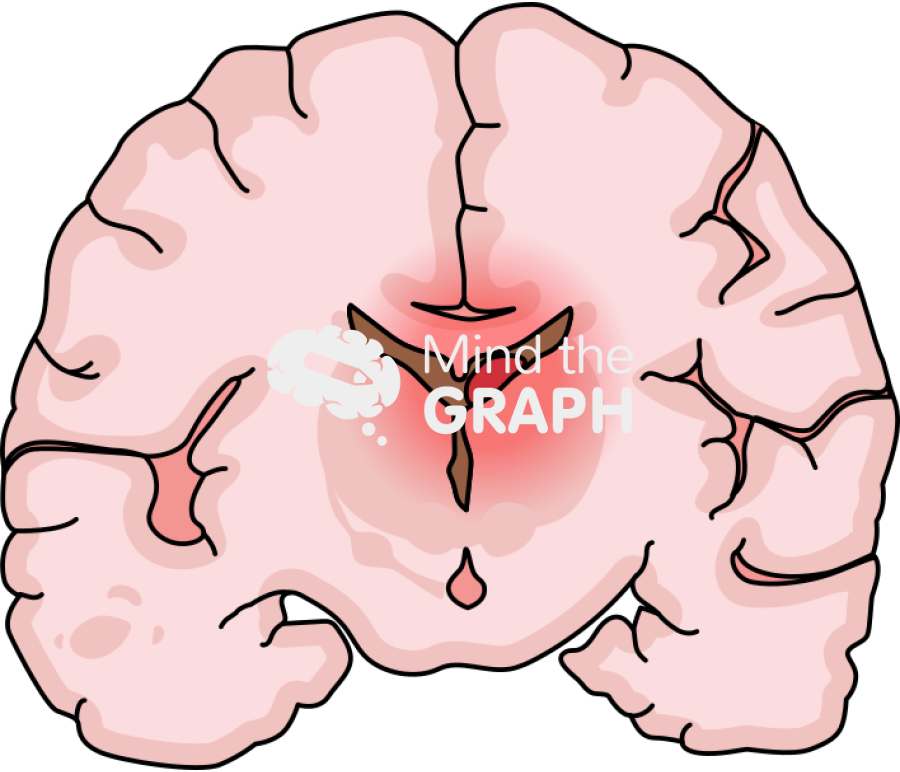 Childish brain hemorrhage 2 front cut Icons, Symbols, Pictures, and Images