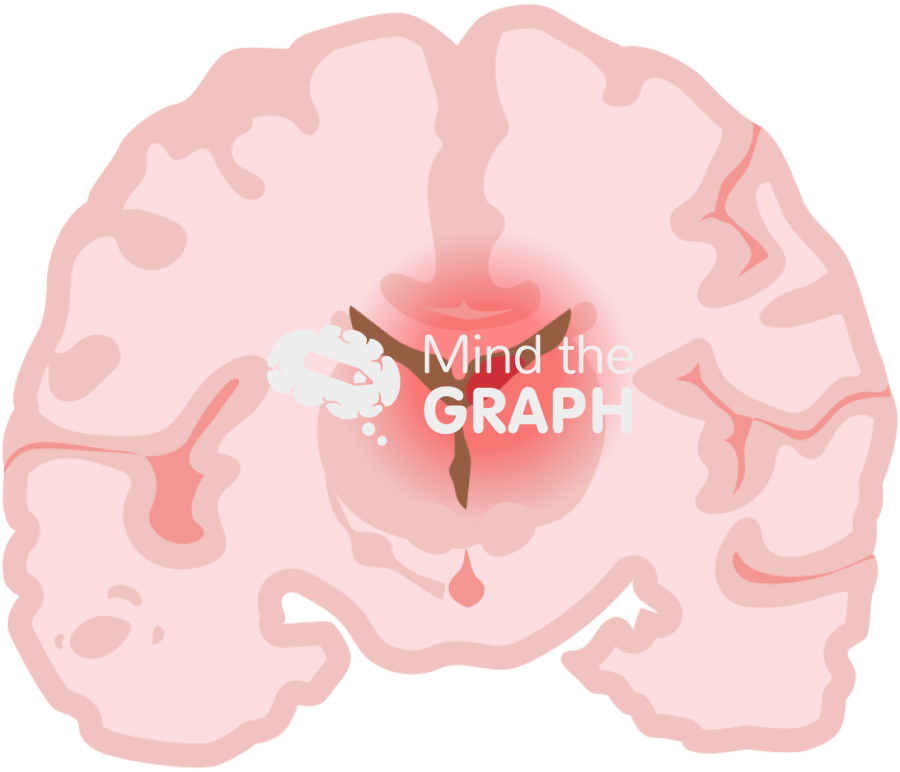 Childish brain hemorrhage 2 front cut Icons, Symbols, Pictures, and Images