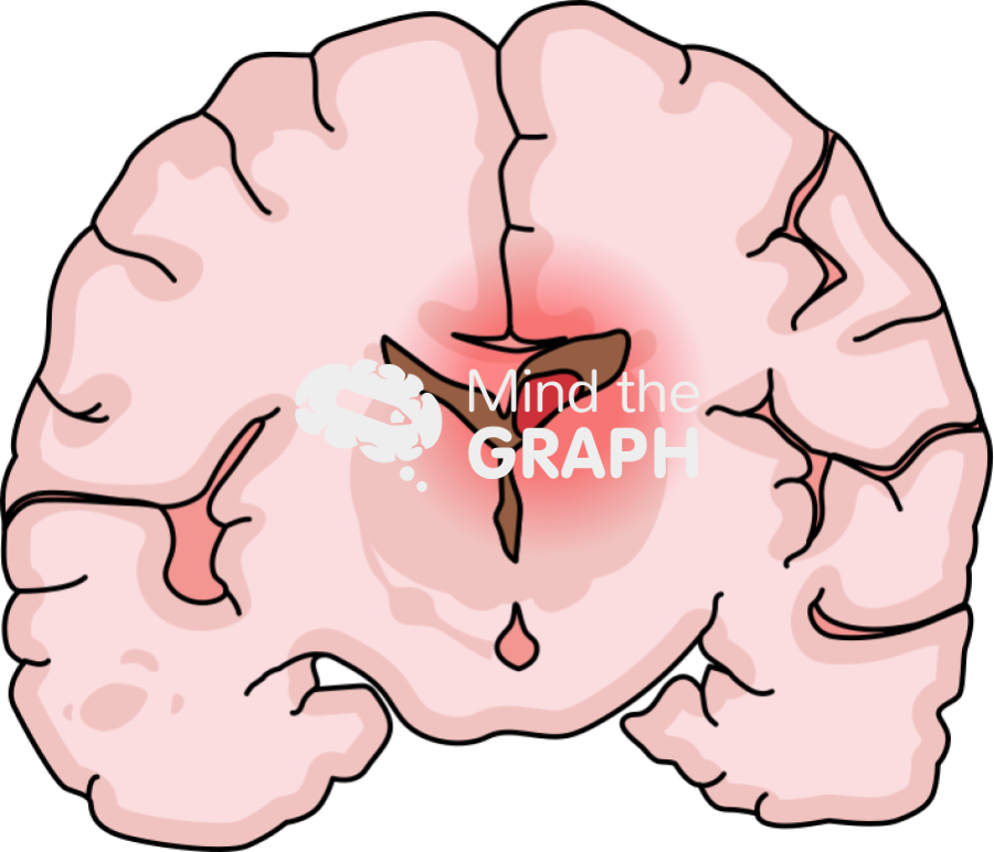 Childish brain hemorrhage 3 front cut Icons, Symbols, Pictures, and Images