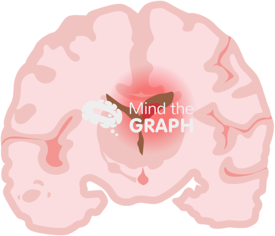 Childish brain hemorrhage 3 front cut Icons, Symbols, Pictures, and Images