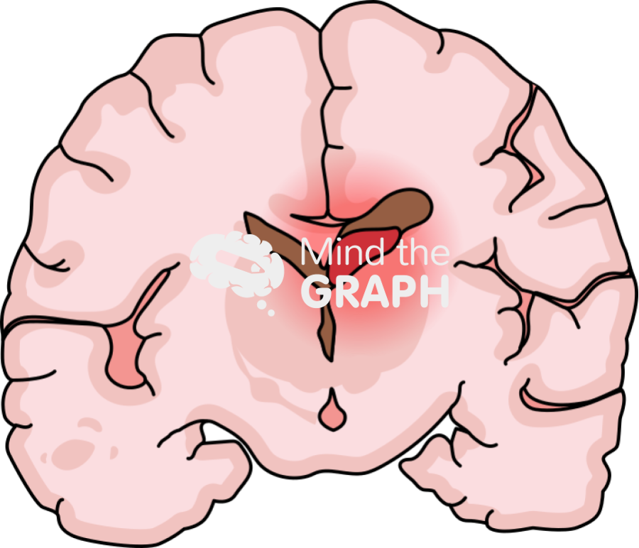 Childish brain hemorrhage 4 front cut Icons, Symbols, Pictures, and Images
