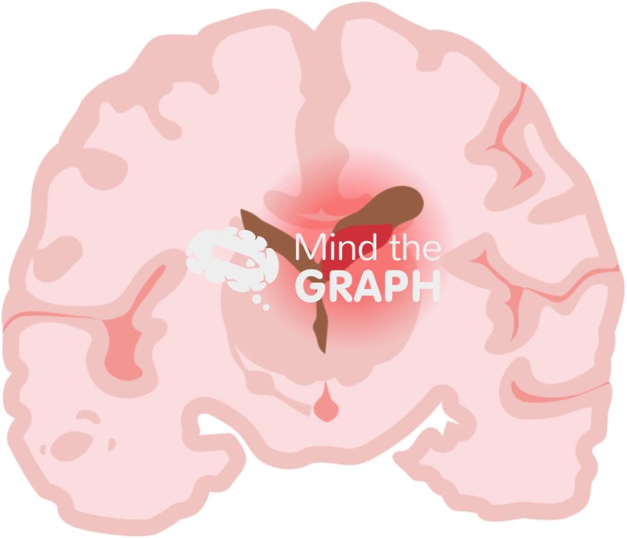 Childish brain hemorrhage 4 front cut Icons, Symbols, Pictures, and Images