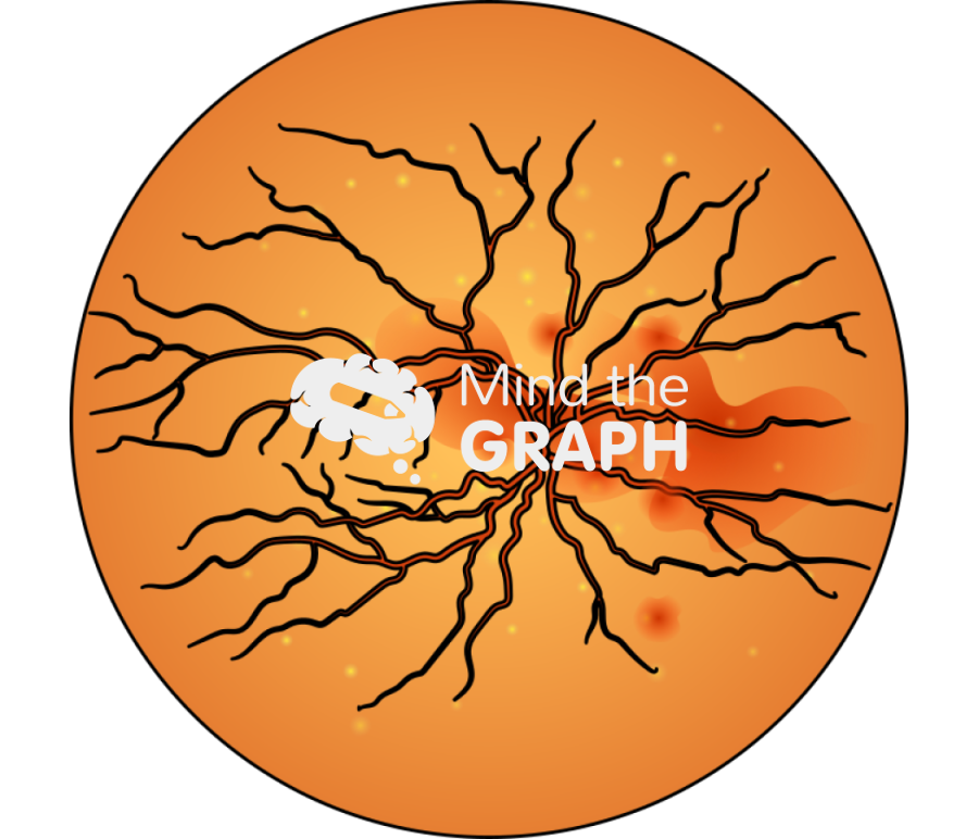 Chorioretinitis 1 zoom Icons, Symbols, Pictures, and Images