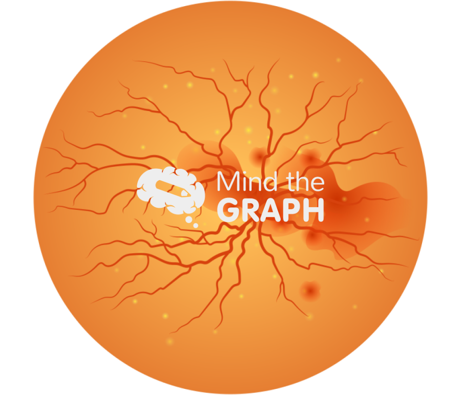 Chorioretinitis 1 zoom Icons, Symbols, Pictures, and Images