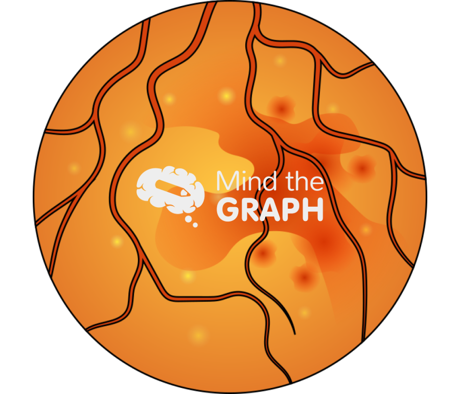 Chorioretinitis 2 zoom Icons, Symbols, Pictures, and Images