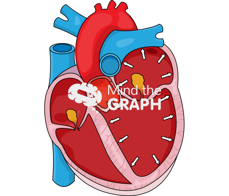 Classical low flow low gradient aortic stenosis Icons, Symbols, Pictures, and Images