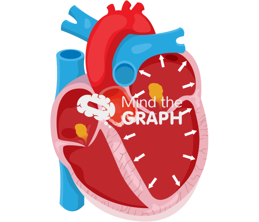 Classical low flow low gradient aortic stenosis Icons, Symbols, Pictures, and Images