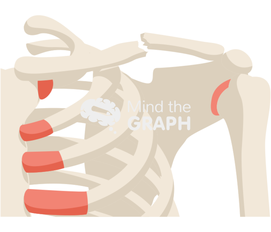 Clavicle fracture Icons, Symbols, Pictures, and Images