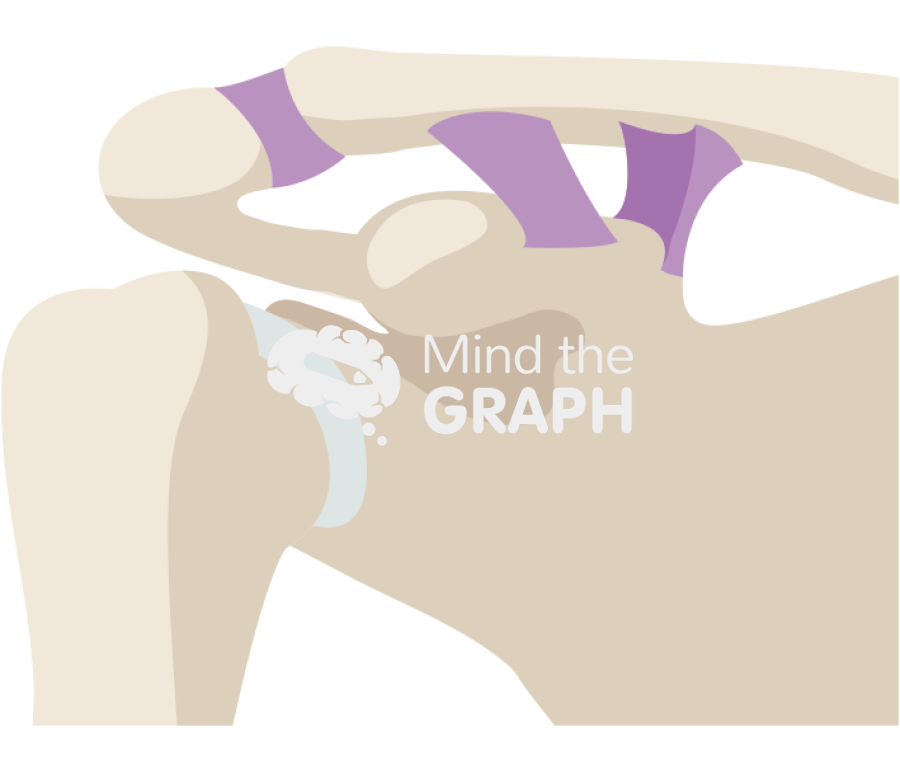 Clavicle fracture crack Icons, Symbols, Pictures, and Images