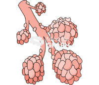 Collapsed alveoli - Edit and Customize Icons of Collapsed alveoli Collapsed alveoli Icons, Symbols, Pictures, and Images