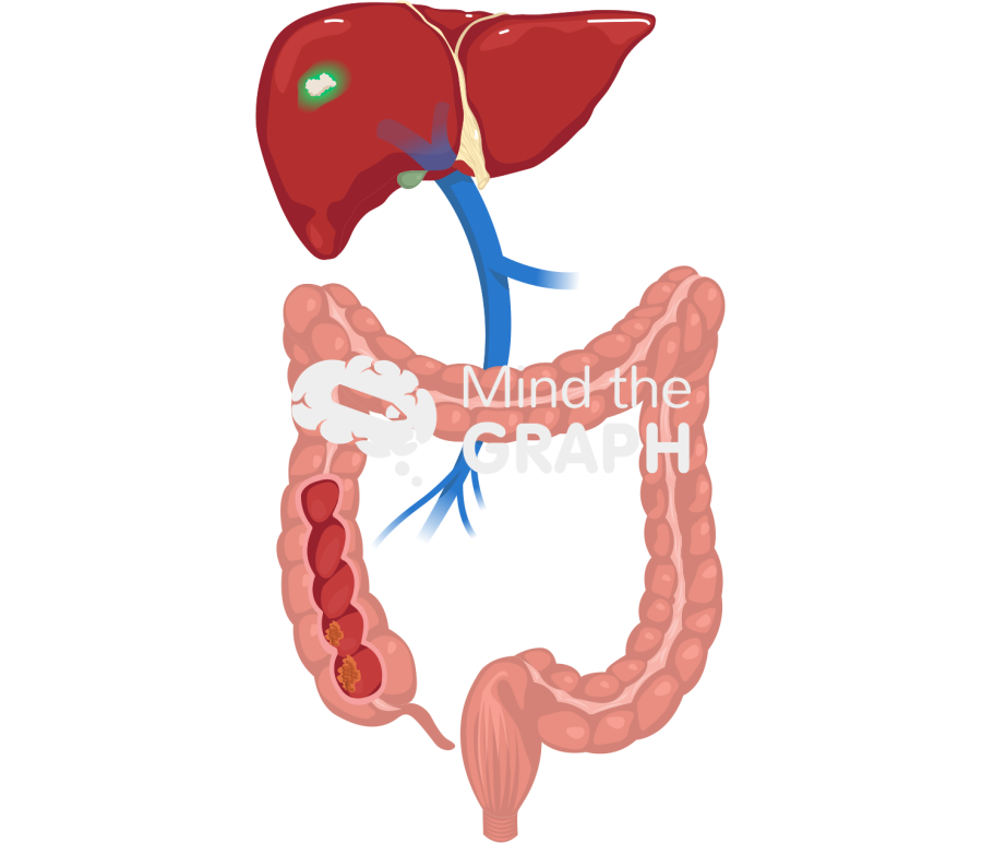 Colorectal liver metastasis indocyanine green icg Icons, Symbols, Pictures, and Images