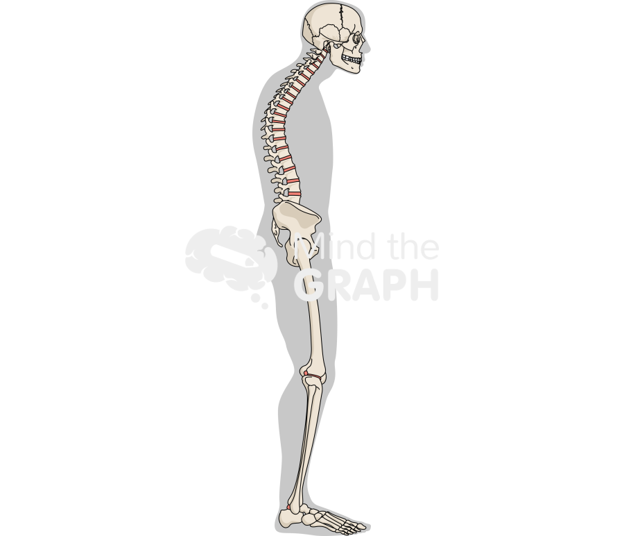 Column sagittally balanced muscle compensation lateral Icons, Symbols, Pictures, and Images