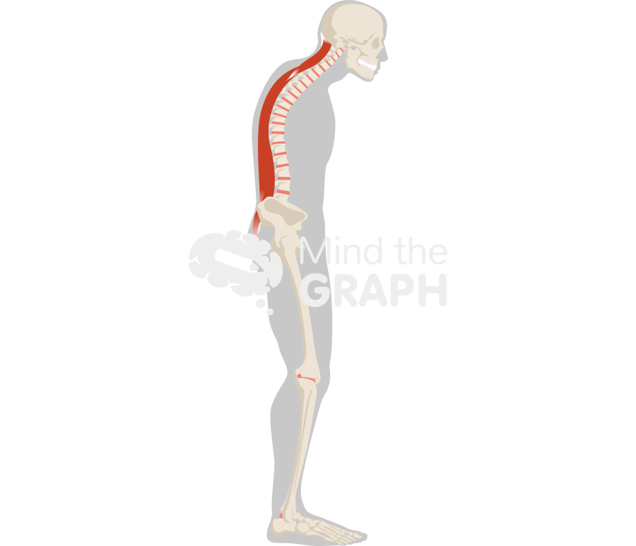 Column sagittally imbalanced erector spinae muscles lateral Icons, Symbols, Pictures, and Images
