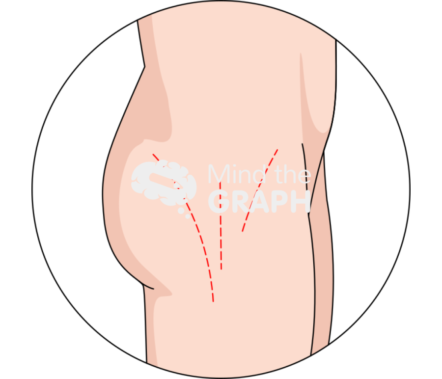 Comparison incisions body zoom Icons, Symbols, Pictures, and Images
