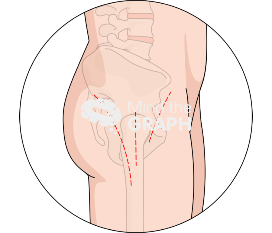 Comparison incisions zoom Icons, Symbols, Pictures, and Images