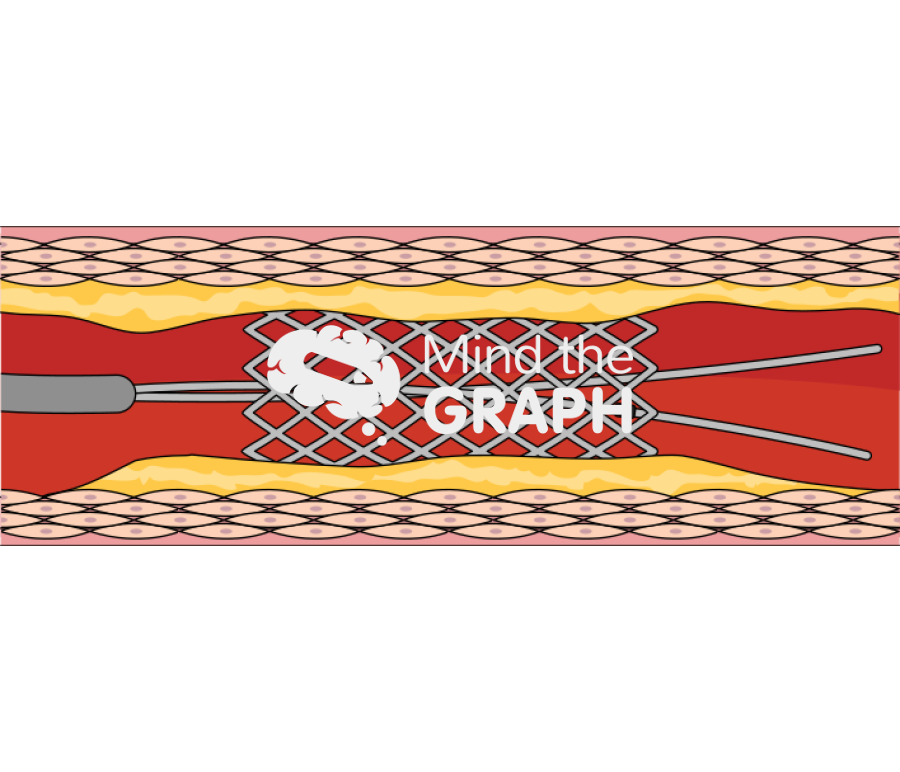 Coronary angiography stent enhancement