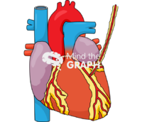 Coronary artery bypass 2 Icons, Symbols, Pictures, and Images