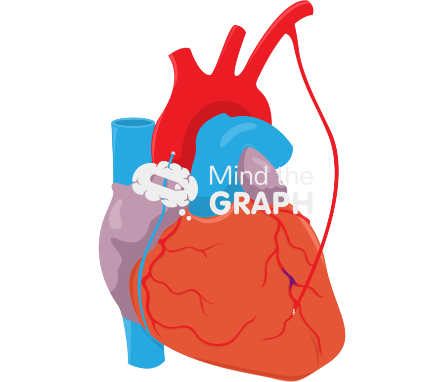 Coronary artery bypass grafting 1 Icons, Symbols, Pictures, and Images