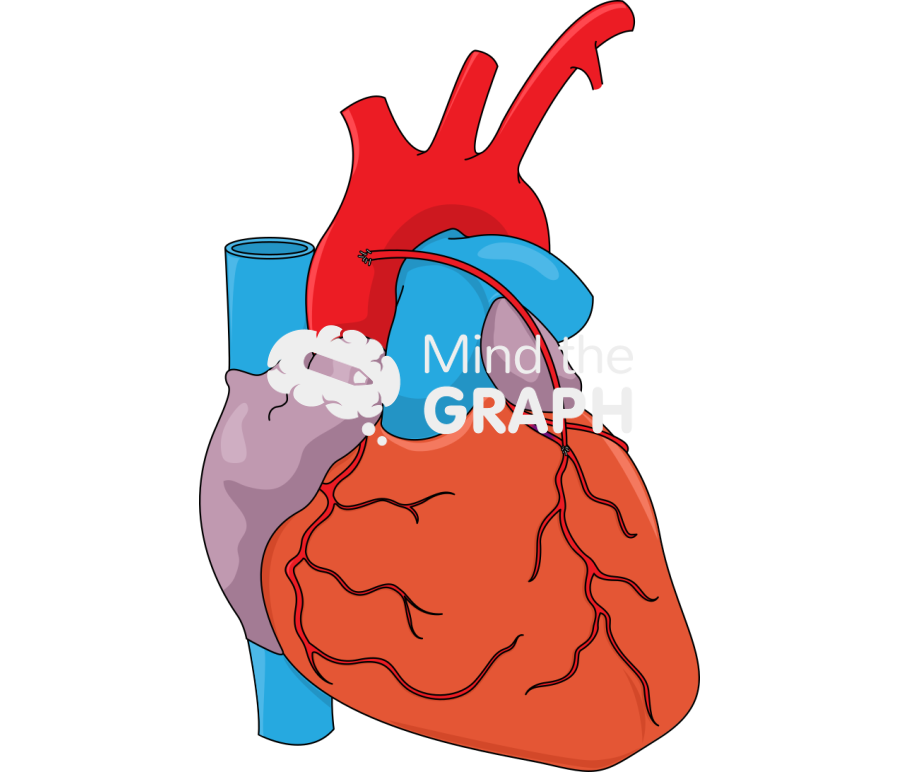 Coronary artery bypass grafting 5 Icons, Symbols, Pictures, and Images