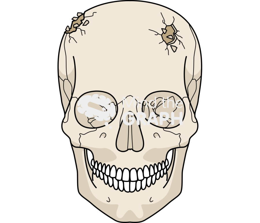 Cranium fracture front Icons, Symbols, Pictures, and Images