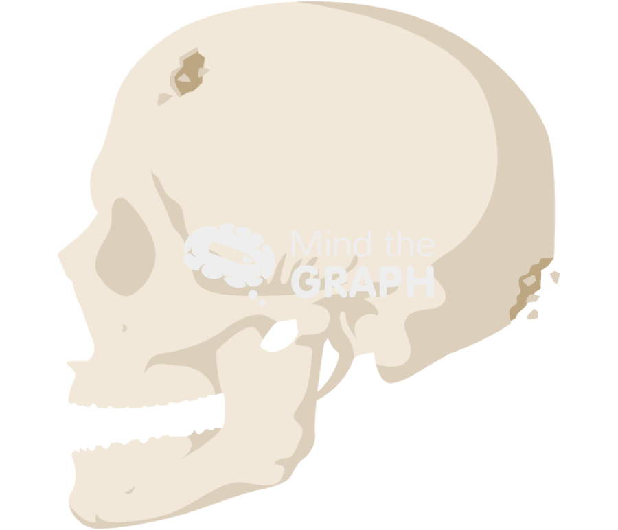 Cranium fracture side Icons, Symbols, Pictures, and Images