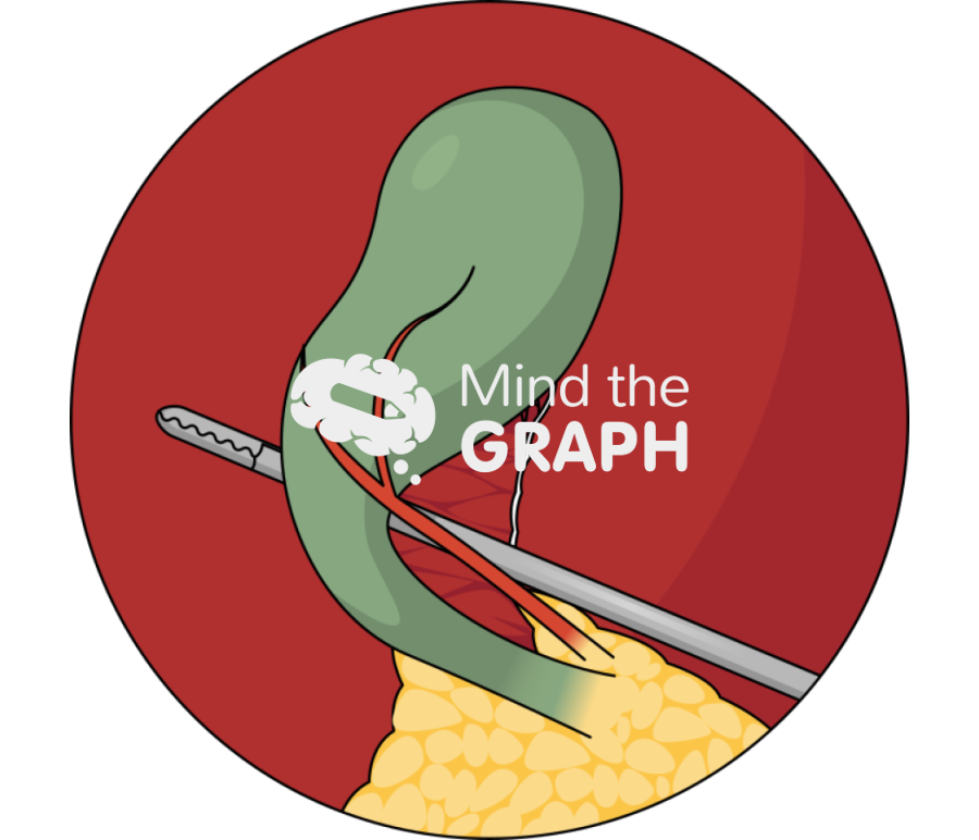 Critical view of safety cvs zoom Icons, Symbols, Pictures, and Images