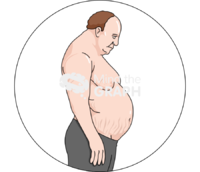 Cushing syndrome zoom - Edit and Customize Icons of Cushing syndrome zoom Cushing syndrome zoom Icons, Symbols, Pictures, and Images