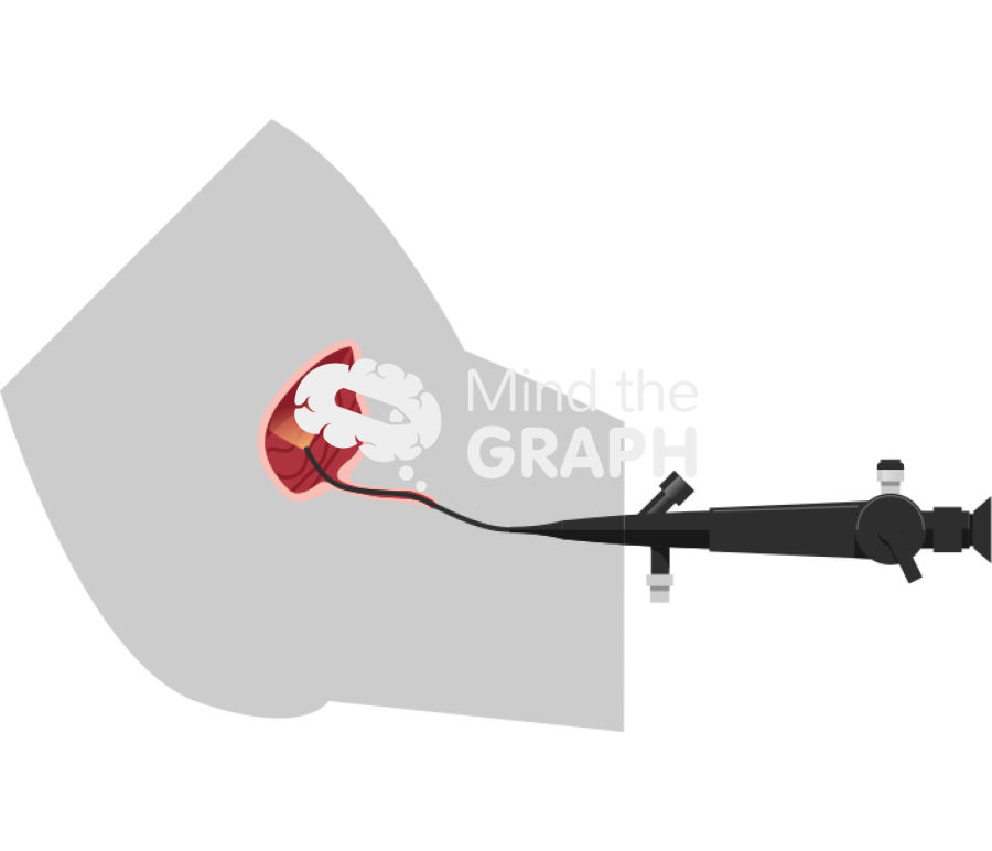 Cystoscopy flexible woman procedure body cut Icons, Symbols, Pictures, and Images