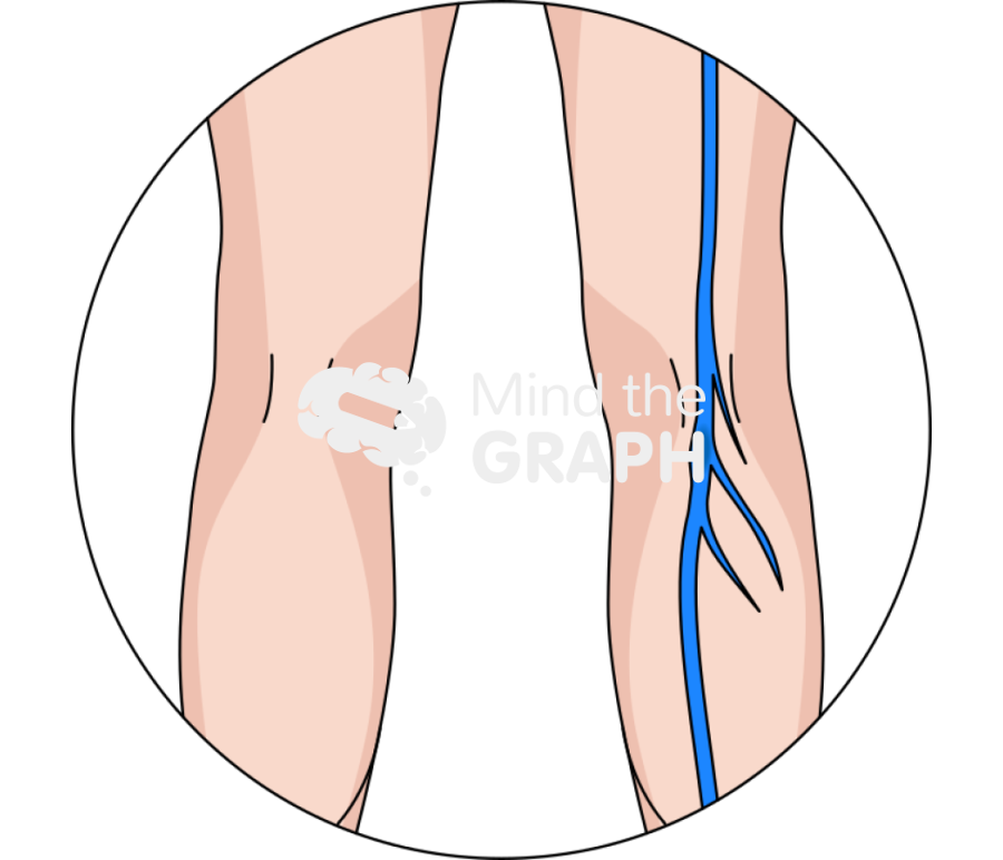 Deep vein thrombosis body zoom Icons, Symbols, Pictures, and Images