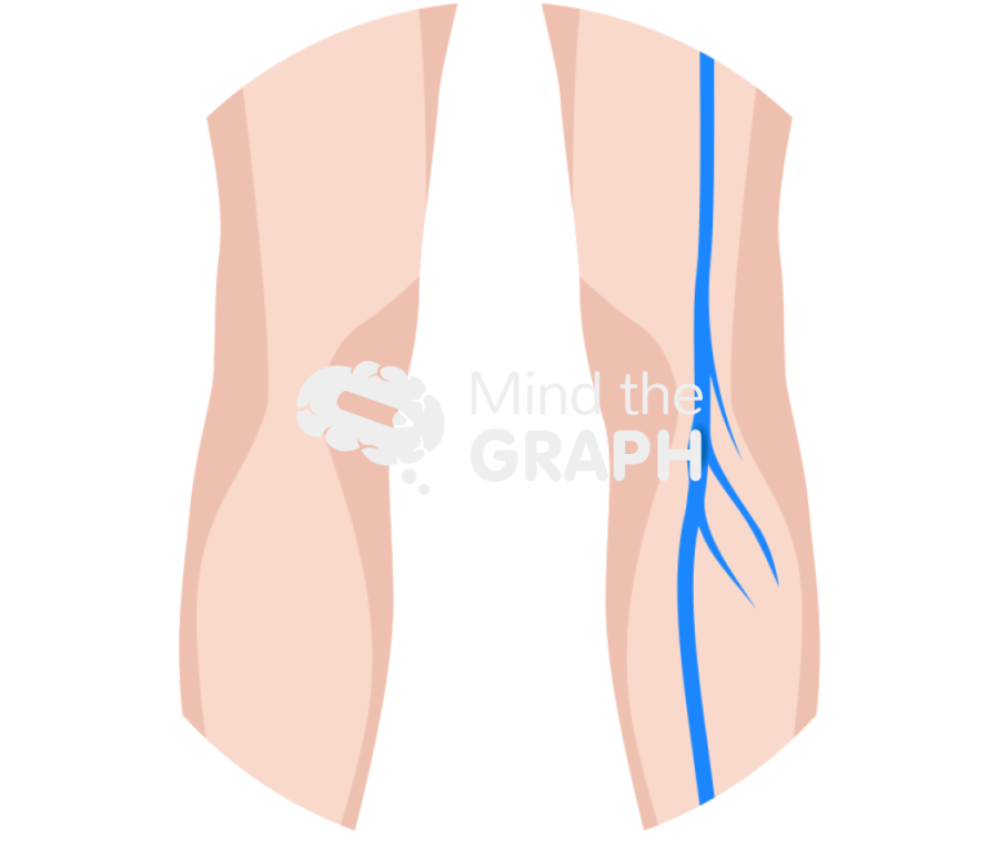Deep vein thrombosis body zoom Icons, Symbols, Pictures, and Images