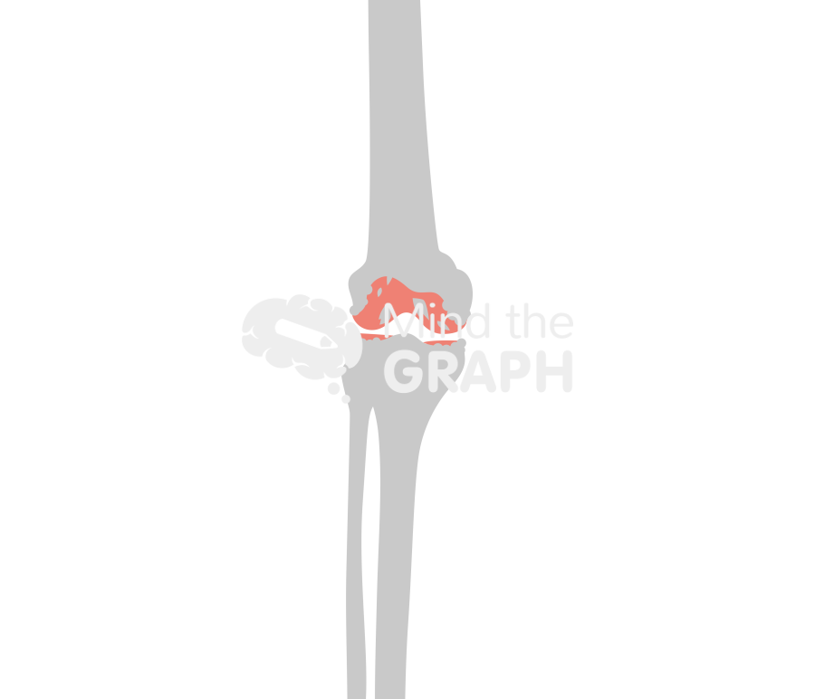 Degenerative joint disease knee animation bone Icons, Symbols, Pictures, and Images