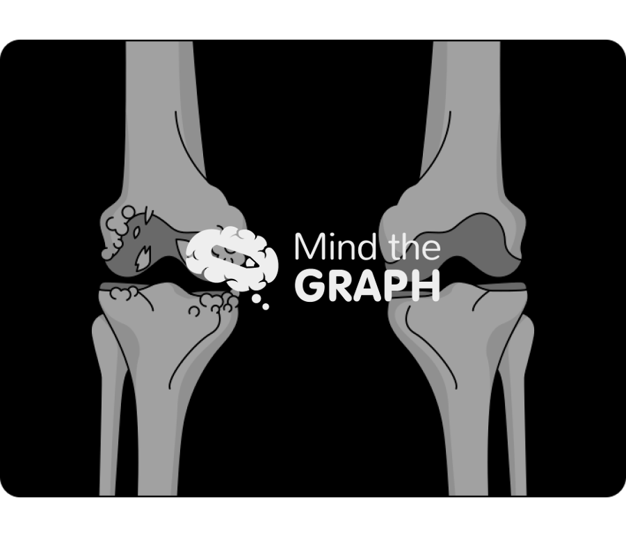 Degenerative joint disease knee x ray Icons, Symbols, Pictures, and Images