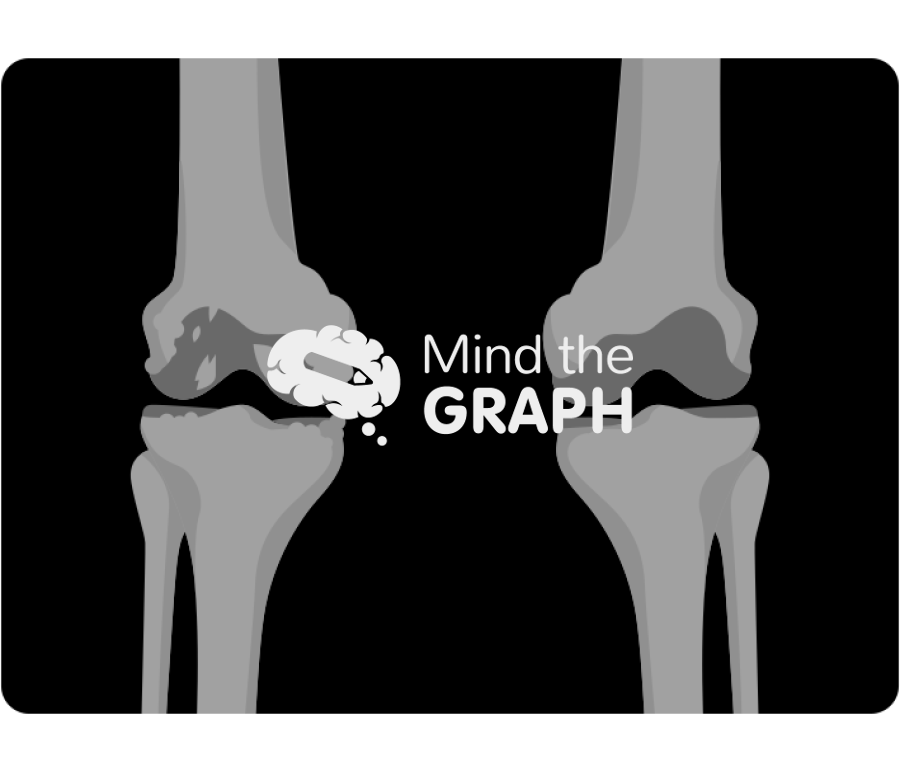 Degenerative joint disease knee x ray Icons, Symbols, Pictures, and Images