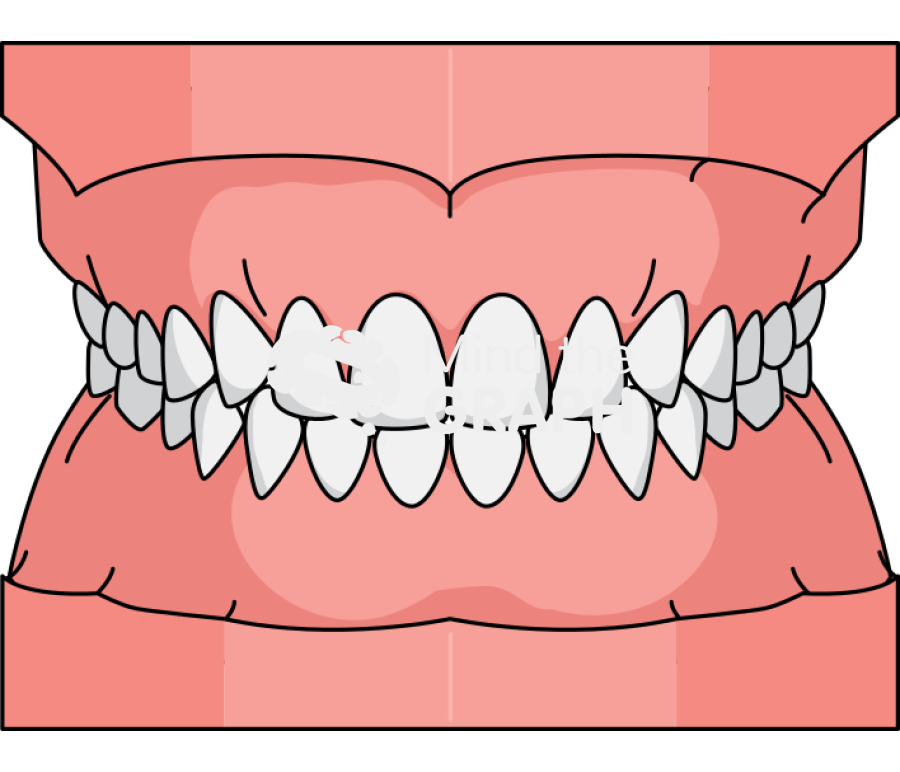 Dental prosthesis 4 Icons, Symbols, Pictures, and Images