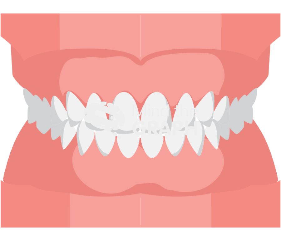 Dental prosthesis 4 Icons, Symbols, Pictures, and Images