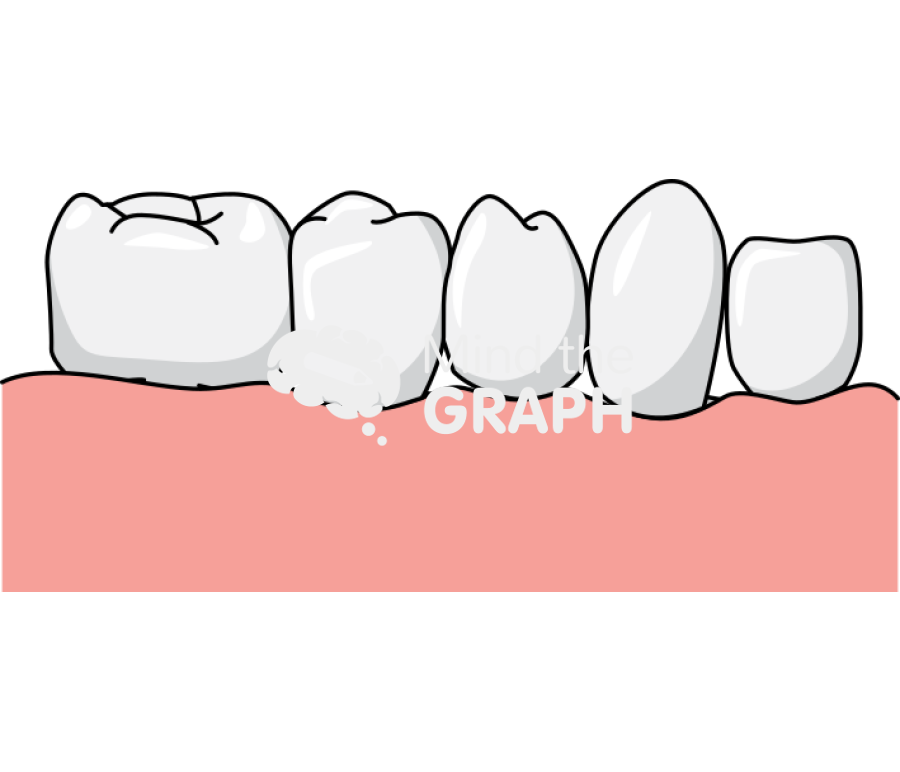 Dental prosthesis lower front 1 Icons, Symbols, Pictures, and Images