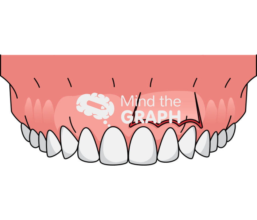 Design parameter soft tissue flap design Icons, Symbols, Pictures, and Images