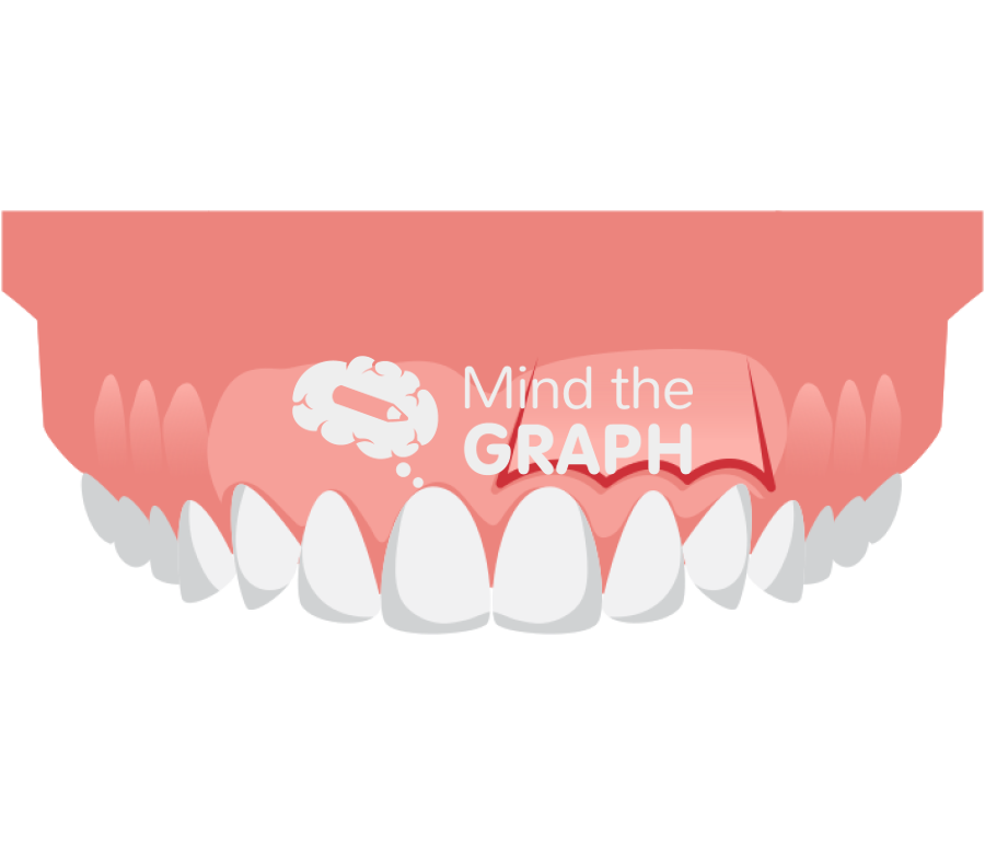 Design parameter soft tissue flap design Icons, Symbols, Pictures, and Images