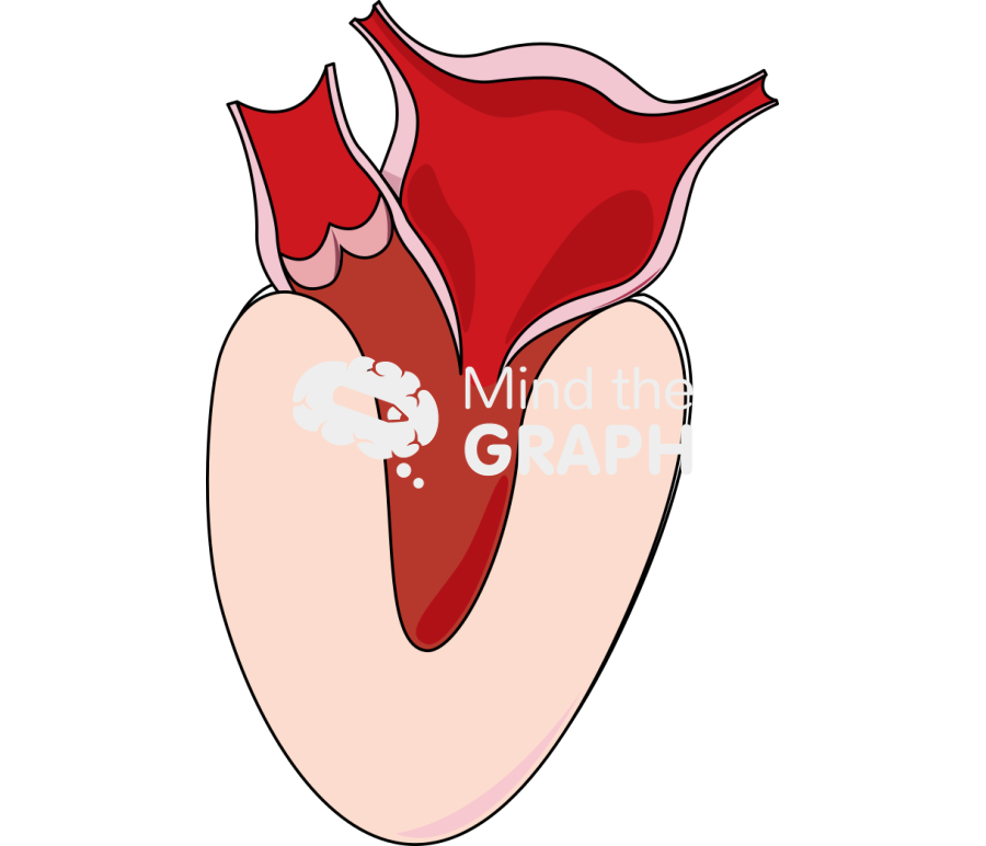 Diastolic dysfunction Icons, Symbols, Pictures, and Images