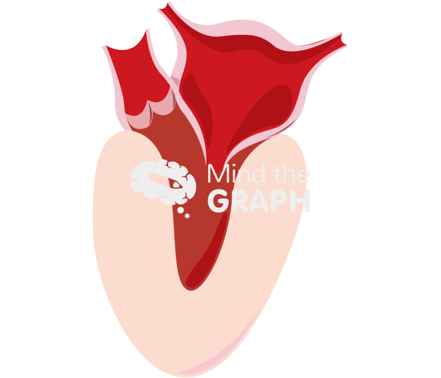 Diastolic dysfunction Icons, Symbols, Pictures, and Images