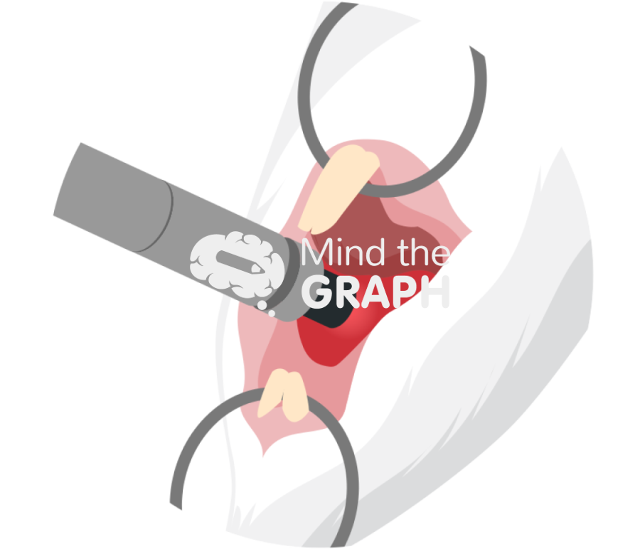 Diode laser probe photobiomodulation Icons, Symbols, Pictures, and Images