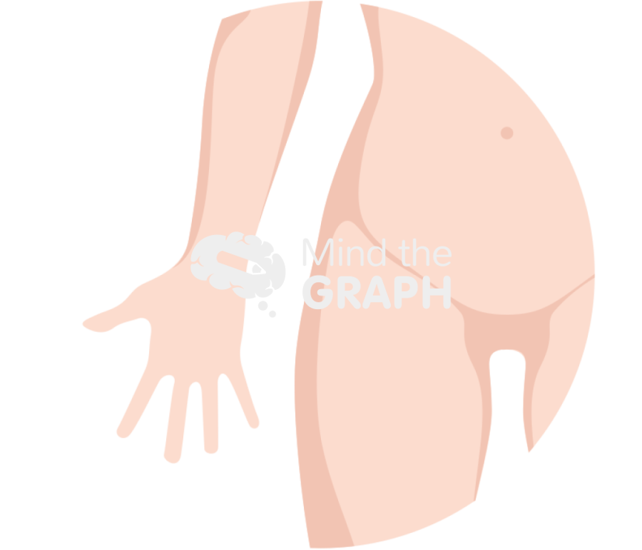 Direct anterior approach daa incision body zoom Icons, Symbols, Pictures, and Images