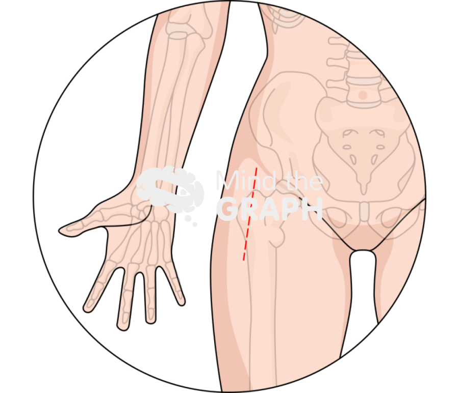 Direct anterior approach daa incision zoom Icons, Symbols, Pictures, and Images