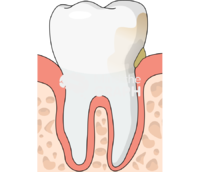 Discolored tooth - Edit and Customize Icons of Discolored tooth Discolored tooth Icons, Symbols, Pictures, and Images