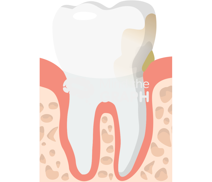 Discolored tooth Icons, Symbols, Pictures, and Images