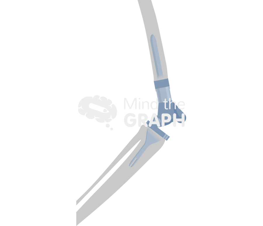 Distal femur replacement lateral bone Icons, Symbols, Pictures, and Images