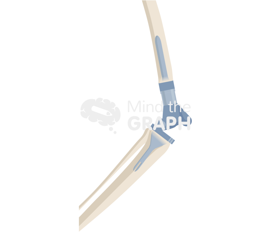 Distal femur replacement lateral bone full Icons, Symbols, Pictures, and Images