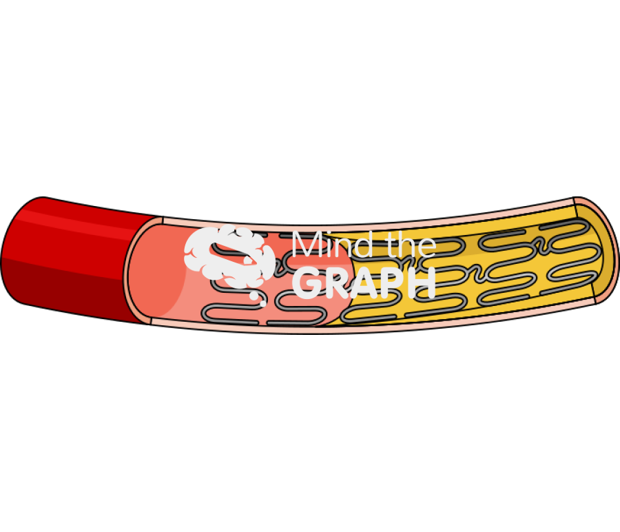 Durable polymer coated stent Icons, Symbols, Pictures, and Images